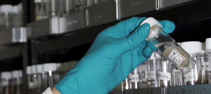 Culture Collection: Microorganism Deposit & Storage